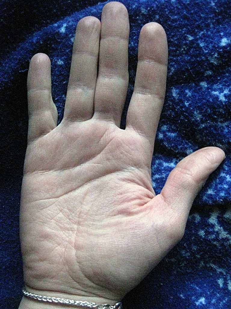 83